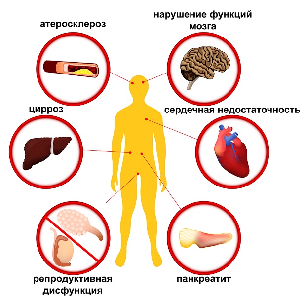 вред алкоголя для органов