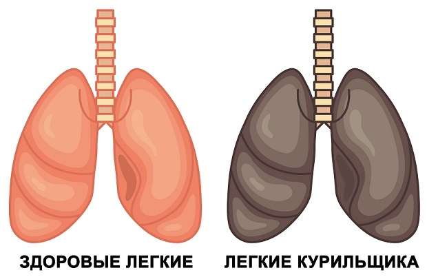 легкие здорового человека и курильщика
