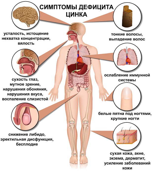 симптомы дефицита цинка