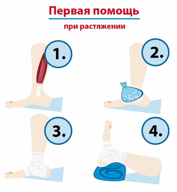 Первая помощь при растяжении